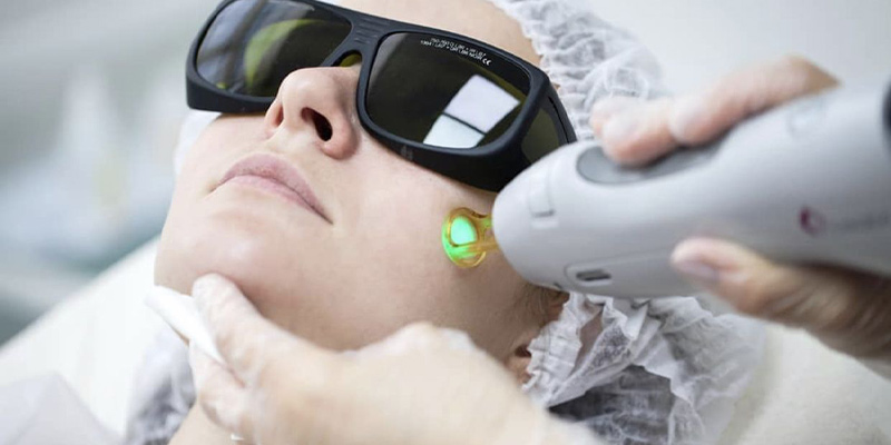 جوابدهی لیزر موهای زائد در نواحی مختلف بدن