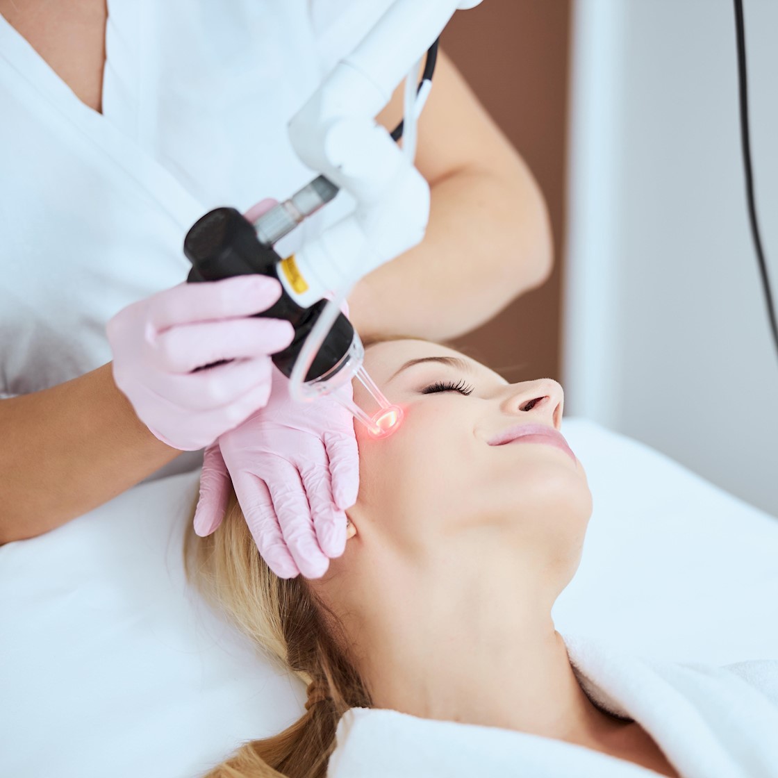 لیزر موهای زائد صورت