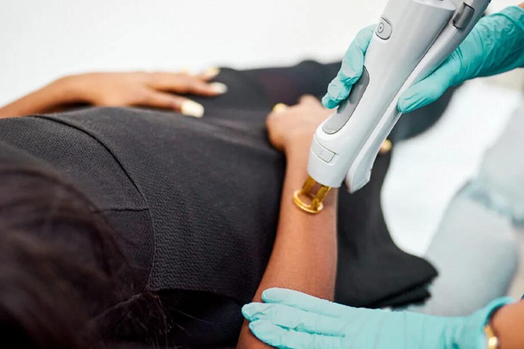 نکاتی برای جوابدهی بهتر از لیزر موهای زائد