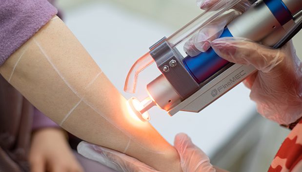 حساسیت‌ های پوستی بعد از لیزر+روش‌های درمان آن