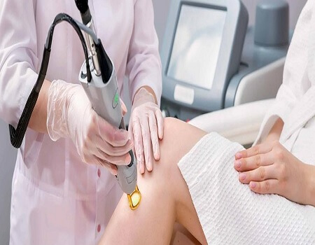 مقایسه لیزر موهای زائد با اپیلاسیون